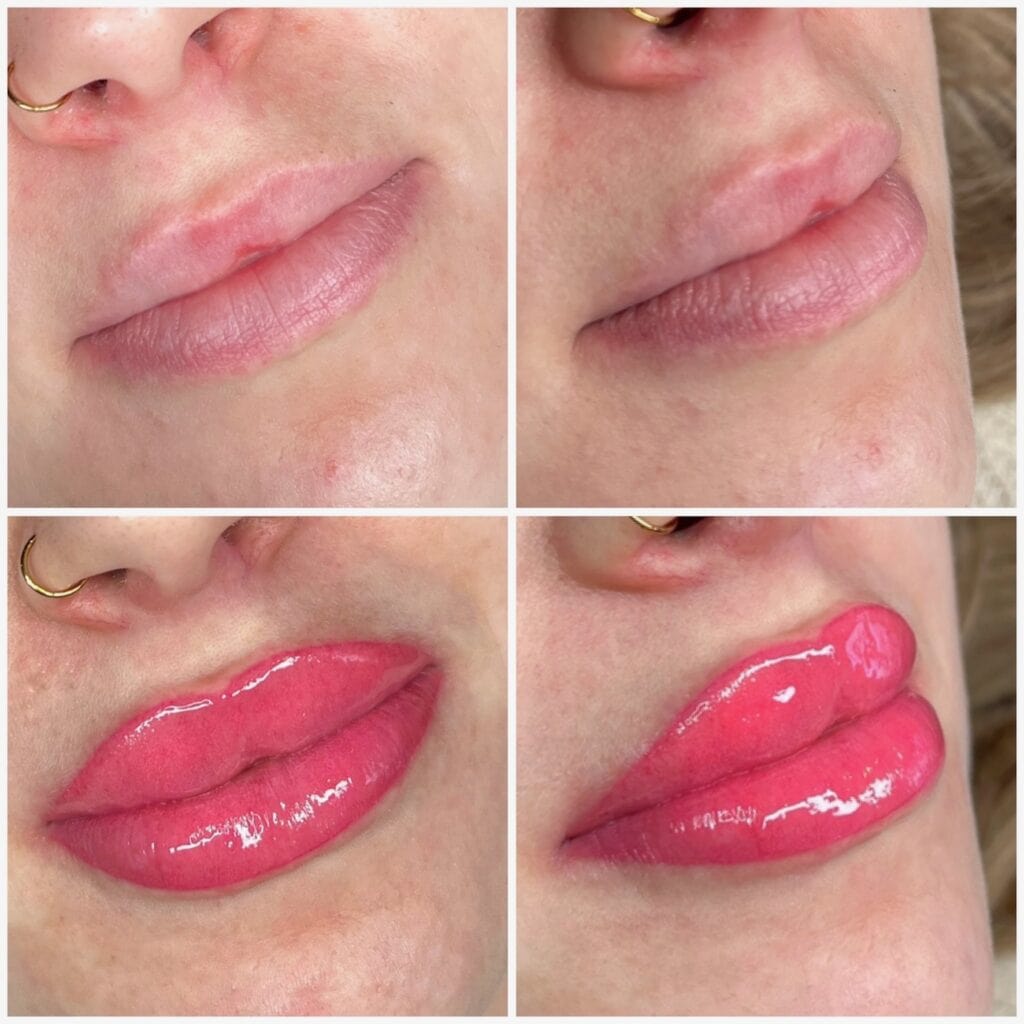 Full lip blush tattoo in pink