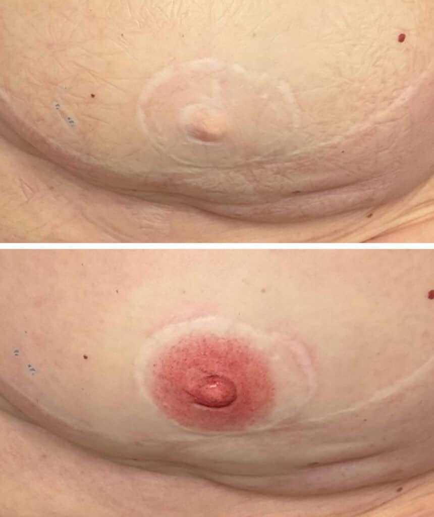 Single nipple tattoo